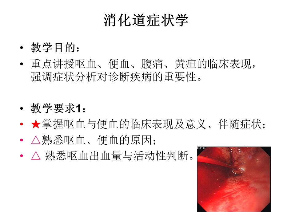 呕血便血腹痛黄疸精讲课件.ppt_第2页