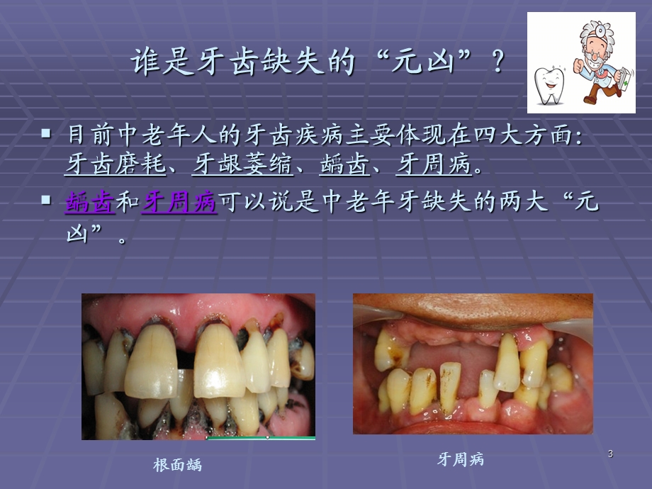 口腔科中老年科普知识讲座课件.ppt_第3页