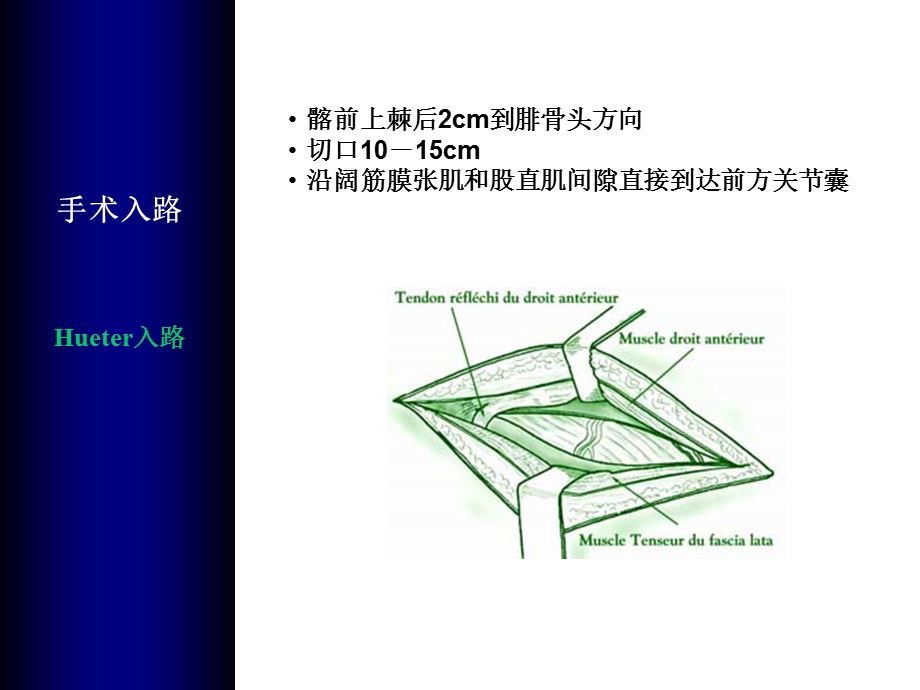 全髋关节置换手术入路教学教材课件.ppt_第3页