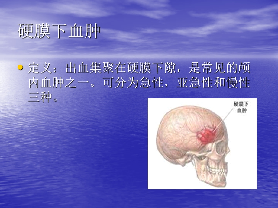 硬膜下血肿的护理查房选编课件.ppt_第3页