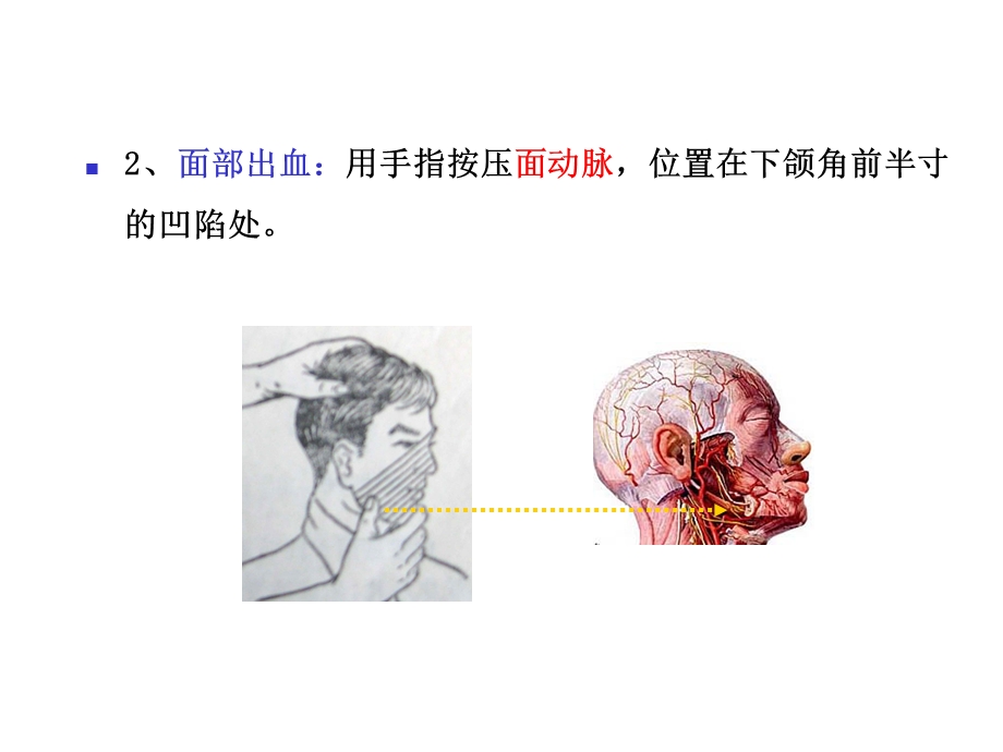 创伤现场急救的四项基本技术教学内容课件.ppt_第3页