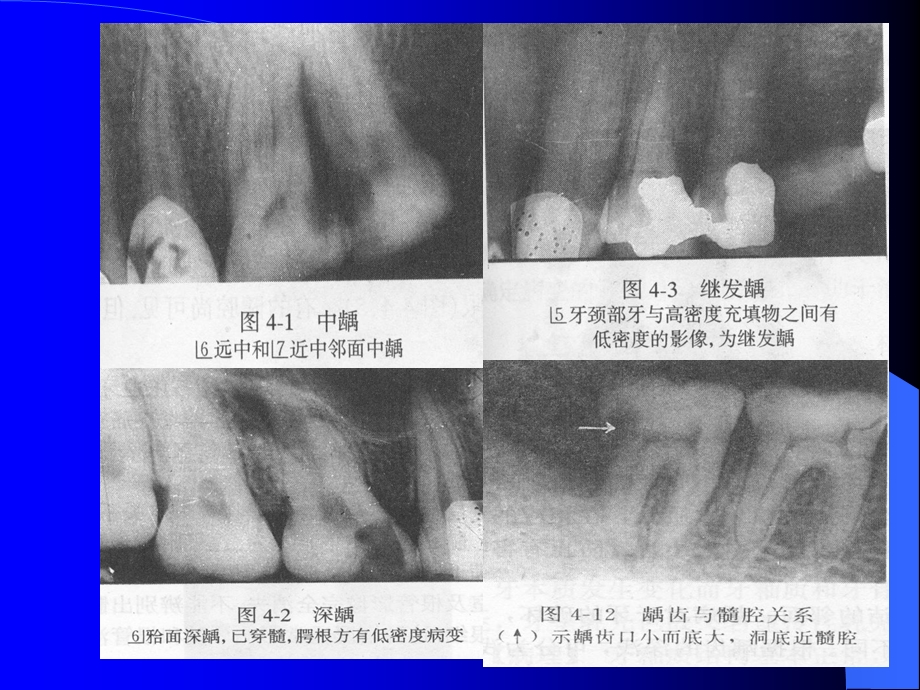 口腔影像学ppt课件.ppt_第3页