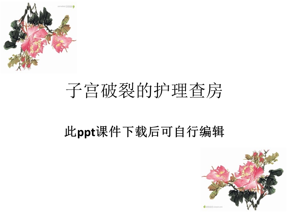 子宫破裂的护理查房—医学ppt课件.ppt_第1页