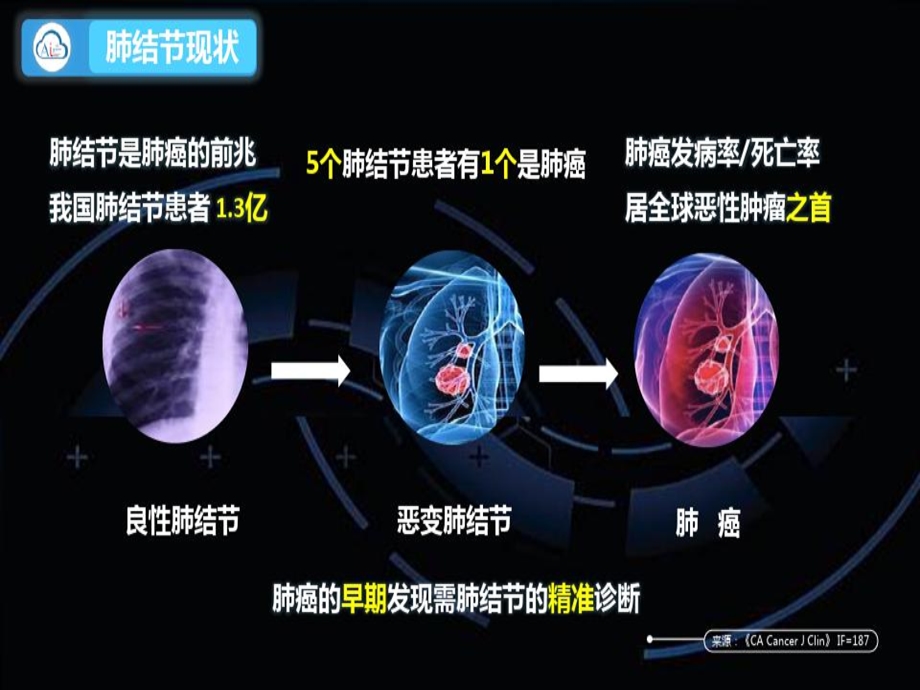 肺结节人工智能课件.ppt_第3页