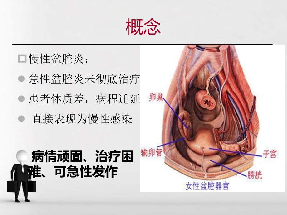 慢性盆腔炎课件.ppt_第2页