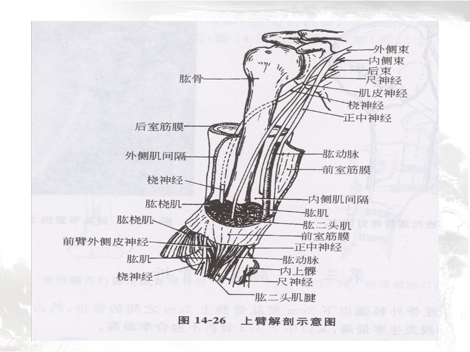 肱骨骨折的护理查房课件.ppt_第3页