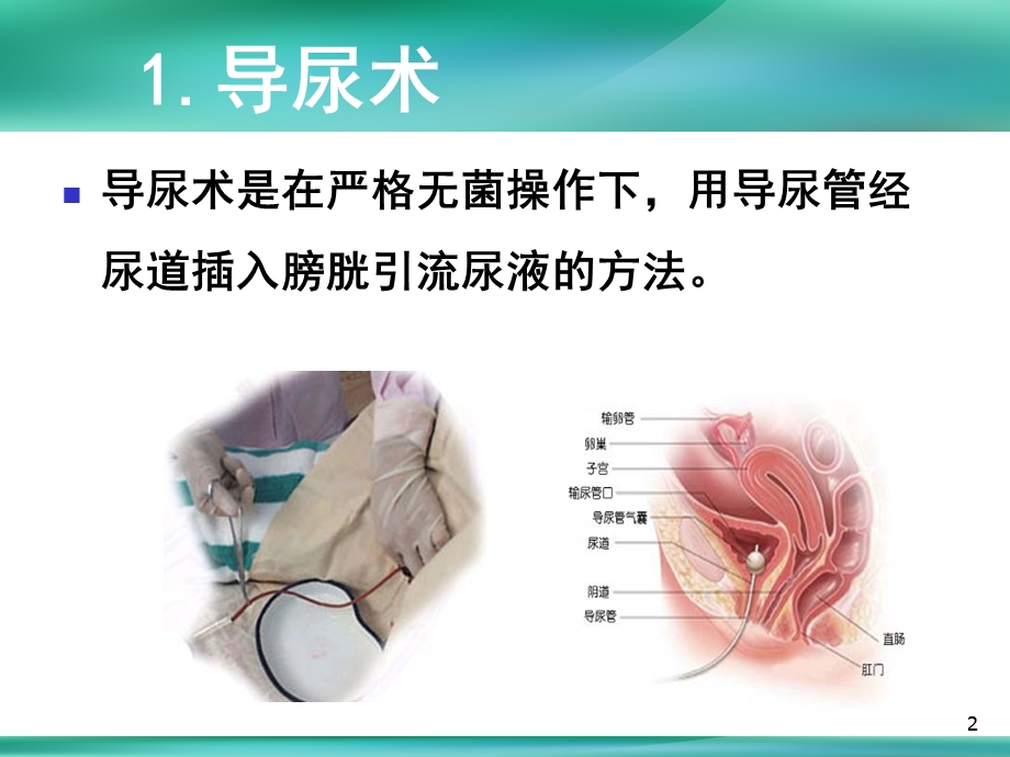 女性导尿术课件.ppt_第2页