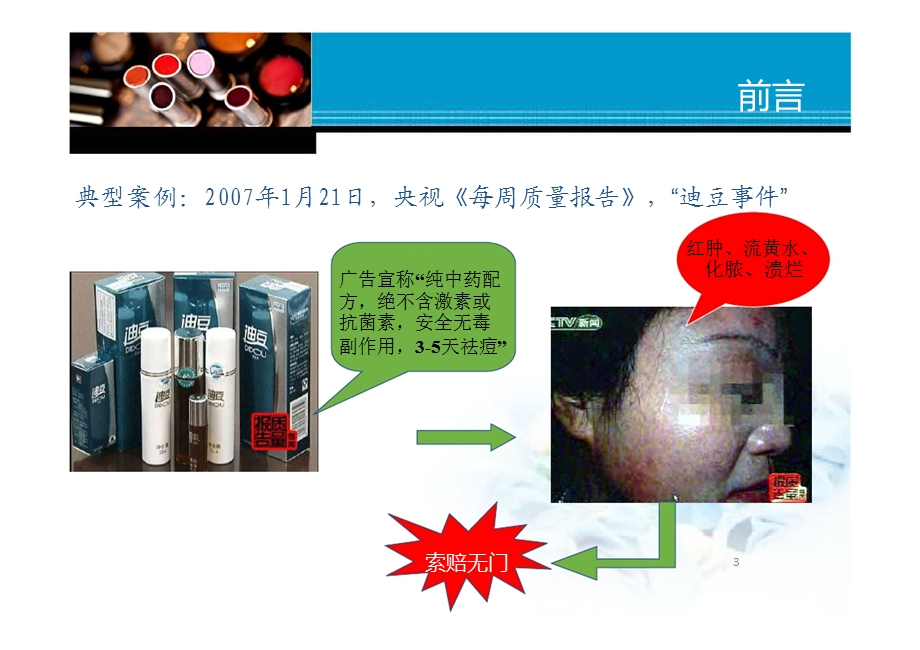 化妆品不良反应监测学习ppt课件.ppt_第3页