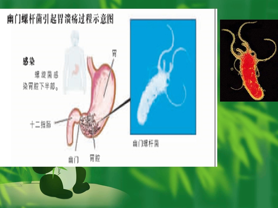 幽门螺杆菌及尿素呼气试验诊断分析课件.ppt_第3页