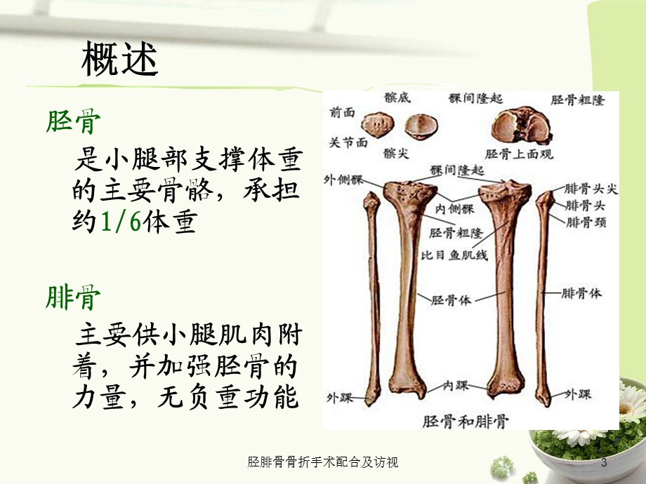 胫腓骨骨折手术配合及访视ppt课件.ppt_第3页