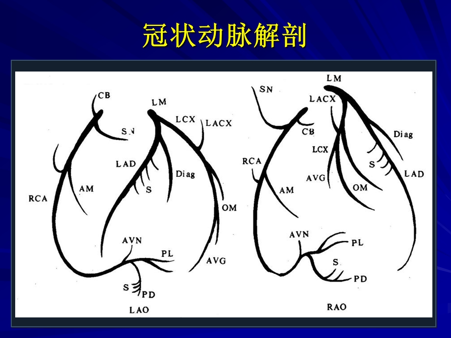 冠状动脉造影的正确判读汇总课件.ppt_第3页