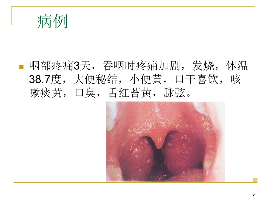 乳--蛾-演示ppt课件.ppt_第3页