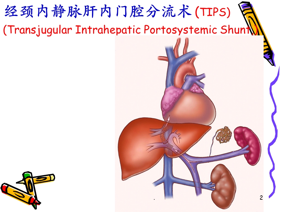 TIPS技术报告课件.ppt_第2页