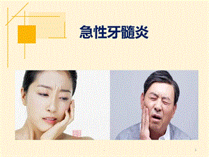 急性牙髓炎课件.ppt