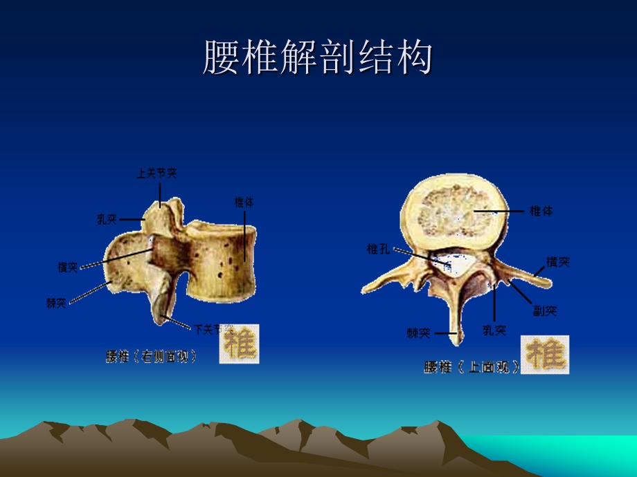 7月腰椎间盘突出症术后护理课件.ppt_第2页