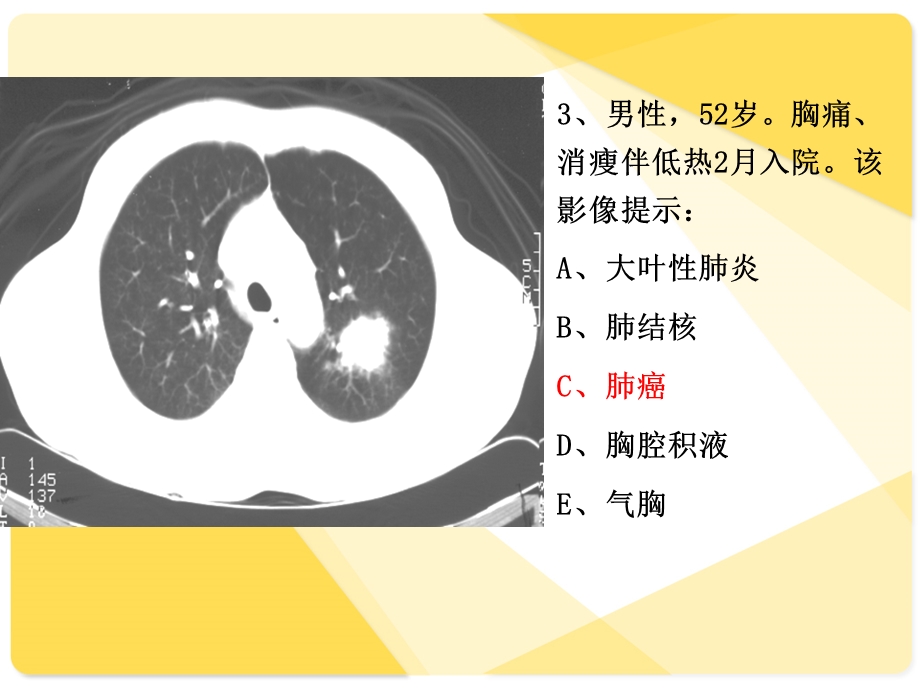 住院医师规陪出科考试辅助检查4课件.ppt_第3页