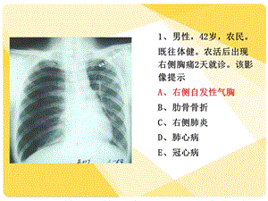 住院医师规陪出科考试辅助检查4课件.ppt