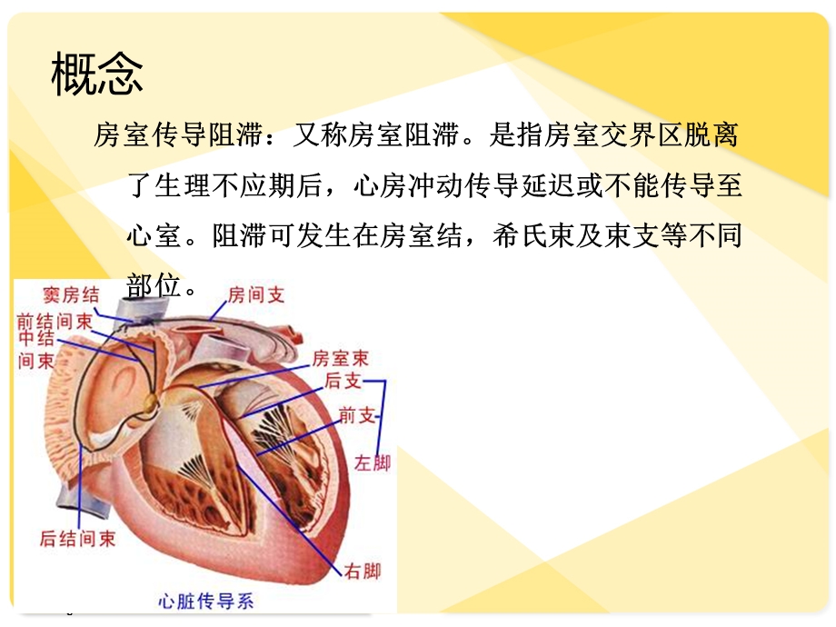 三度房室传导阻滞护理查房演示ppt课件.ppt_第3页