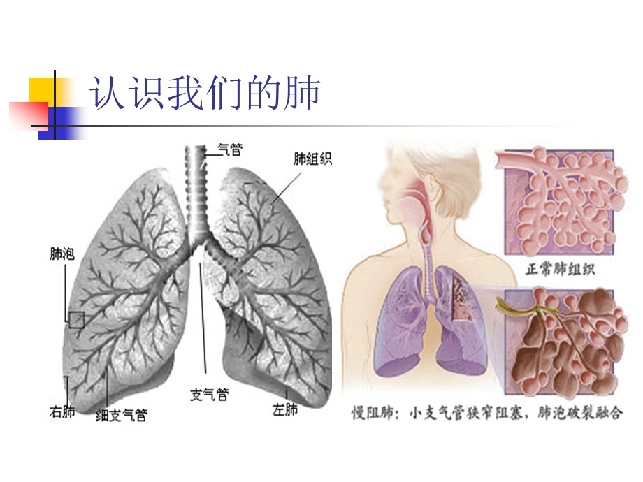 COPD病人的康复指导课件.ppt_第3页