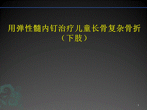 儿童长骨骨折弹性髓内钉课件.ppt