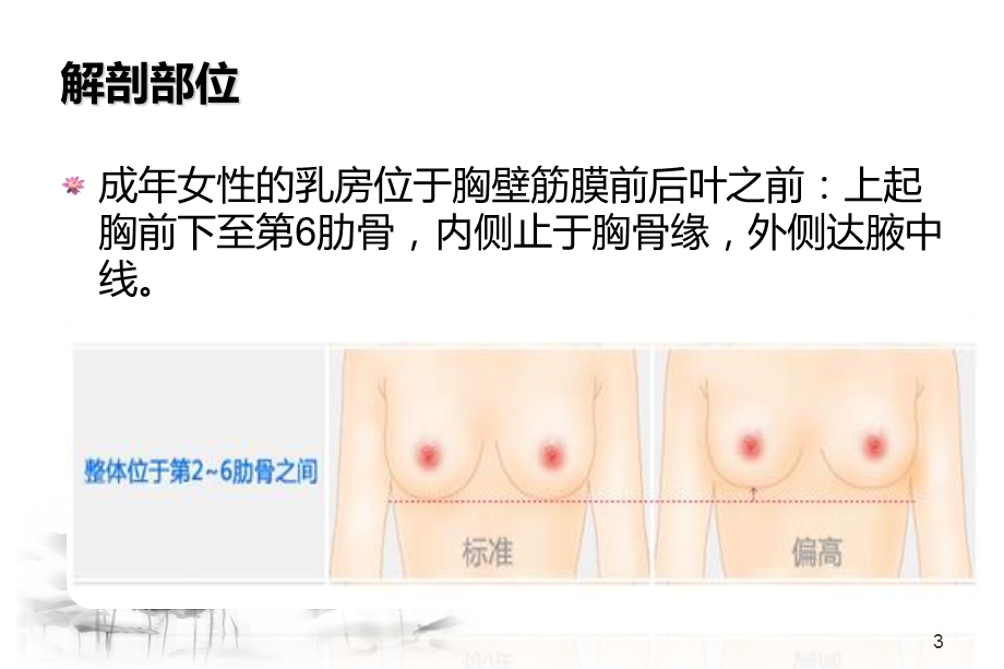 乳腺癌疾病课件.ppt_第3页