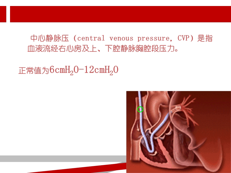 中心静脉压CVP监测课件.ppt_第2页