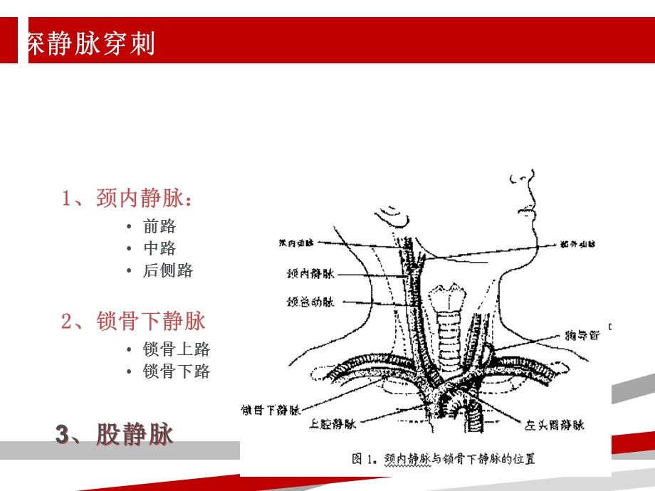 中心静脉压CVP监测课件.ppt_第3页