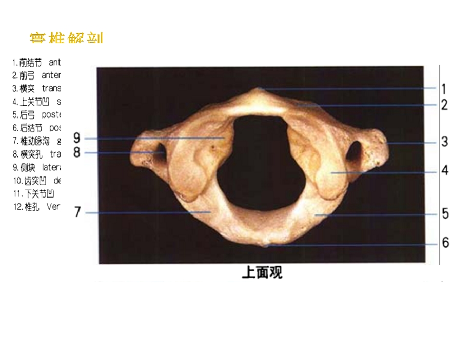 寰枢关节半脱位课件.ppt_第3页