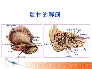 颞骨的解剖 课件.ppt