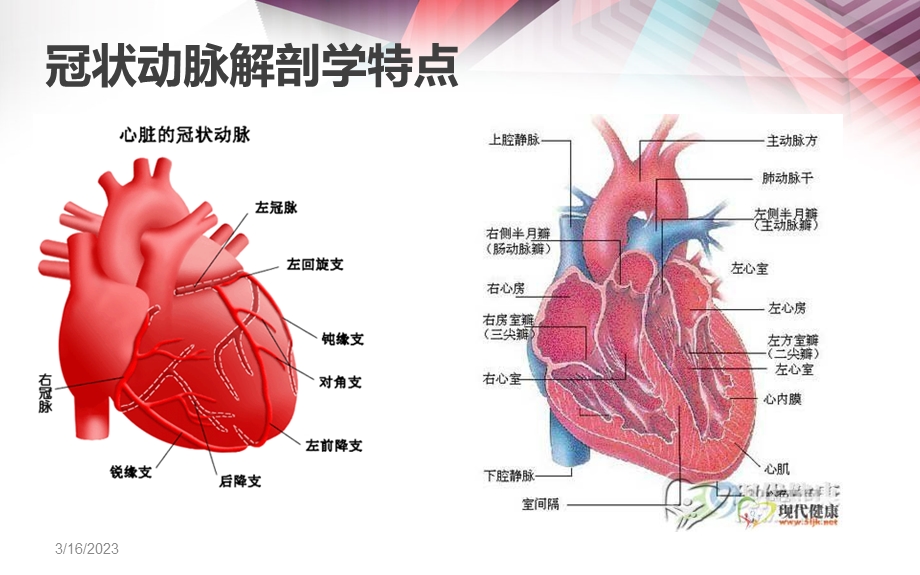 冠脉造影术汇总课件.ppt_第3页