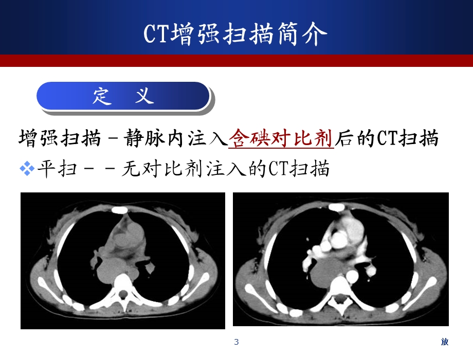 CT增强扫描的临床应用 课件.ppt_第3页