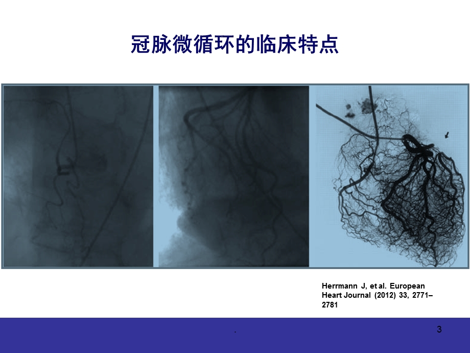 冠脉微血管病变的临床特点与防治课件.pptx_第3页