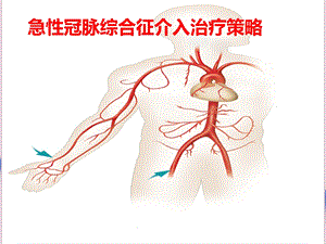 急性冠脉综合征介入治疗策略课件.ppt