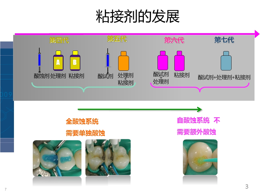 3M树脂微创美学修复医学课件.pptx_第3页