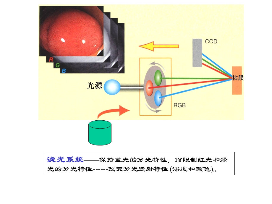 NBI显像技术的临床应用.ppt_第3页