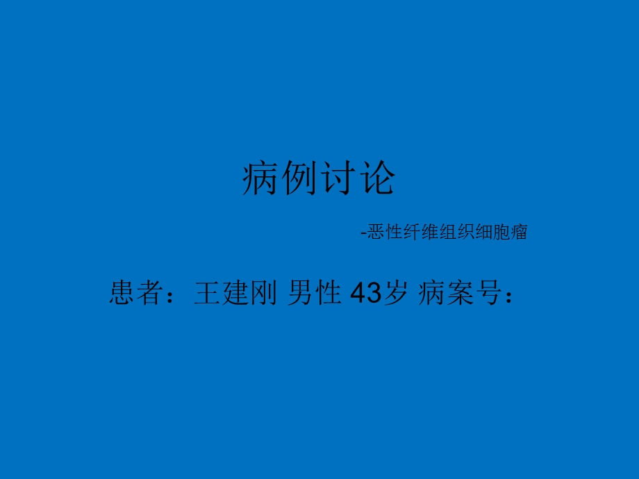 恶性纤维组织细胞瘤ppt幻灯片.ppt_第1页