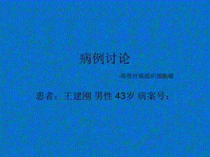 恶性纤维组织细胞瘤ppt幻灯片.ppt