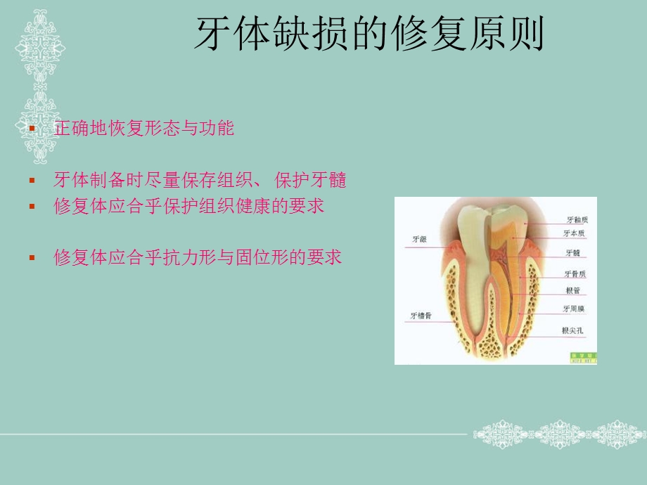 牙体缺损的修复原则.ppt_第3页