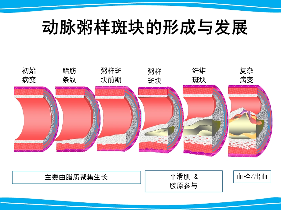 冠心病及心衰的药物治疗.ppt_第3页