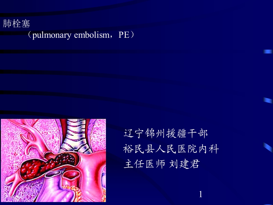 [精彩]肺栓塞讲课.ppt_第1页