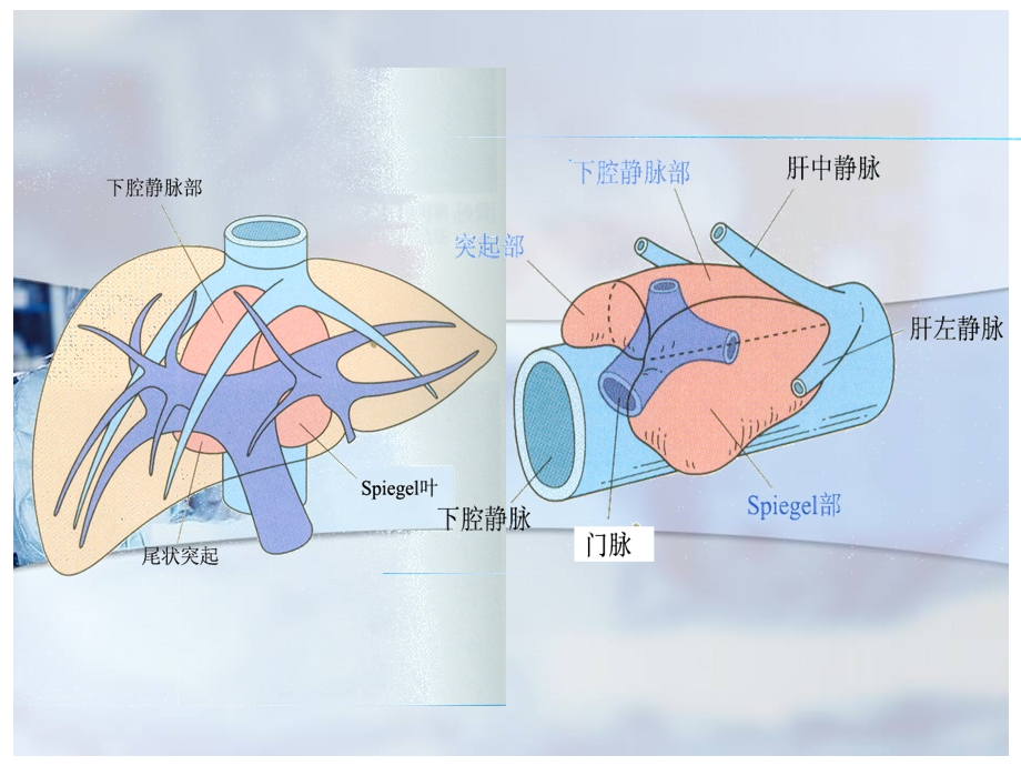 肝脏尾状叶图文.ppt_第3页