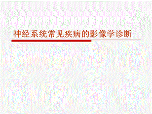 中枢神经系统肿瘤影像学诊断.ppt