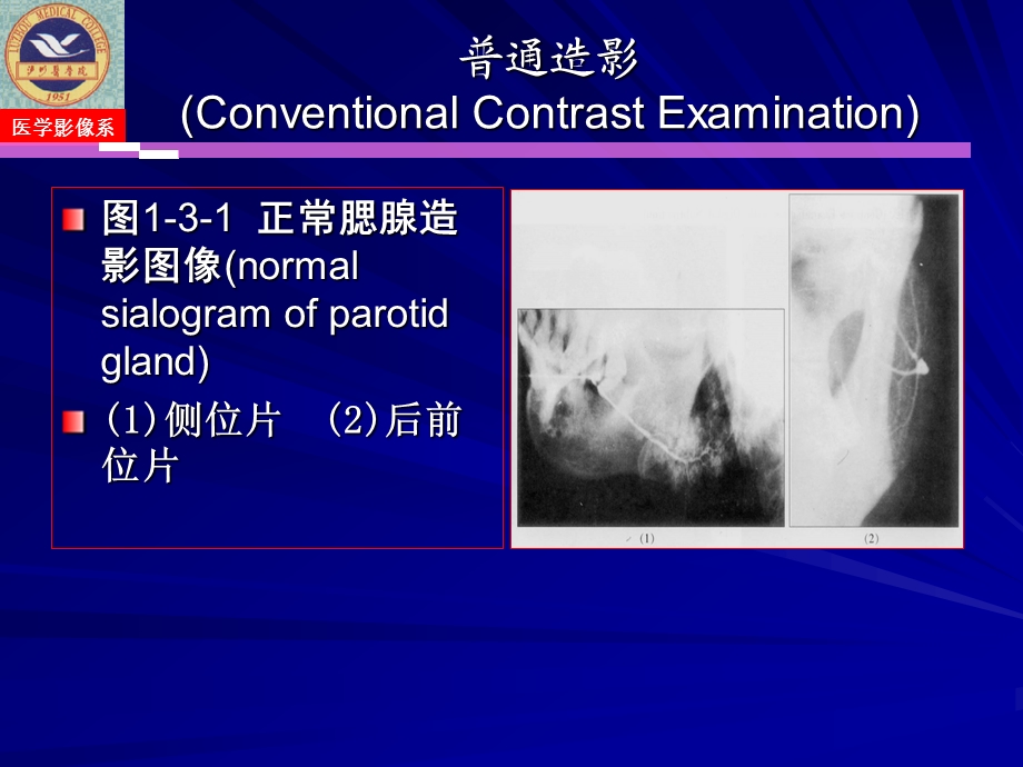 涎腺疾病与颞下颌关节疾病影像诊断.ppt_第3页