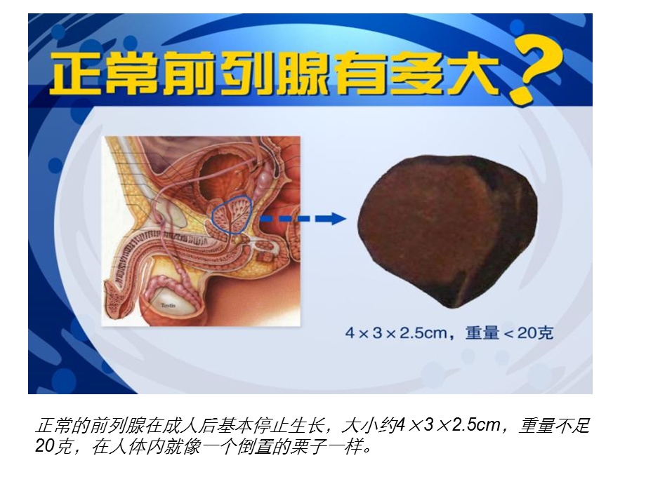 前列腺增生的基础知识ppt.ppt_第3页