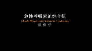 急性呼吸窘迫综合征(ARDS)的影像学表现.ppt