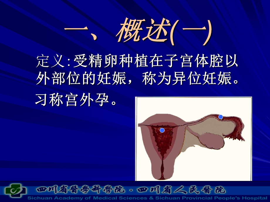 异位妊娠及护理..ppt_第3页