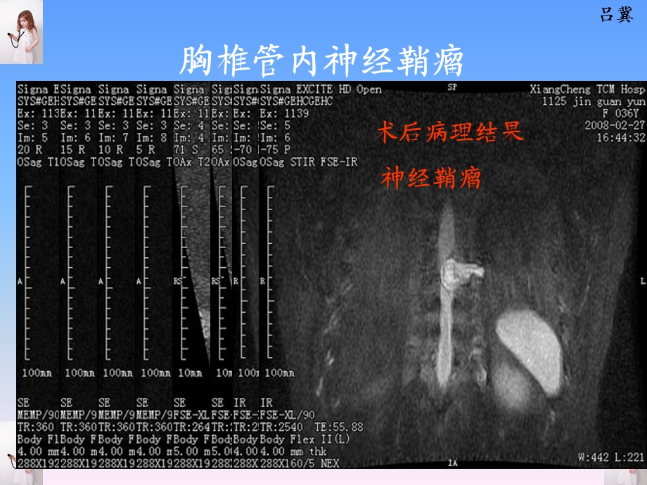 CNS疾病MRI诊断.ppt_第3页