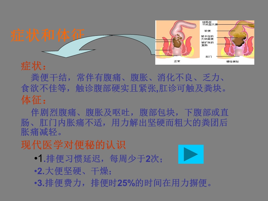 冠心病与便秘.ppt_第2页