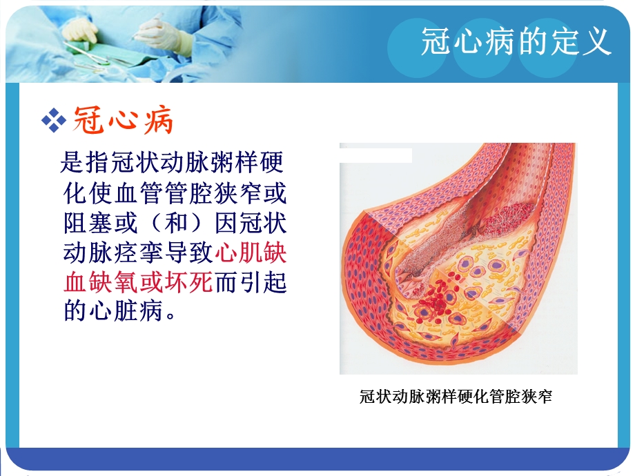 冠心病围术期的护理.ppt_第2页