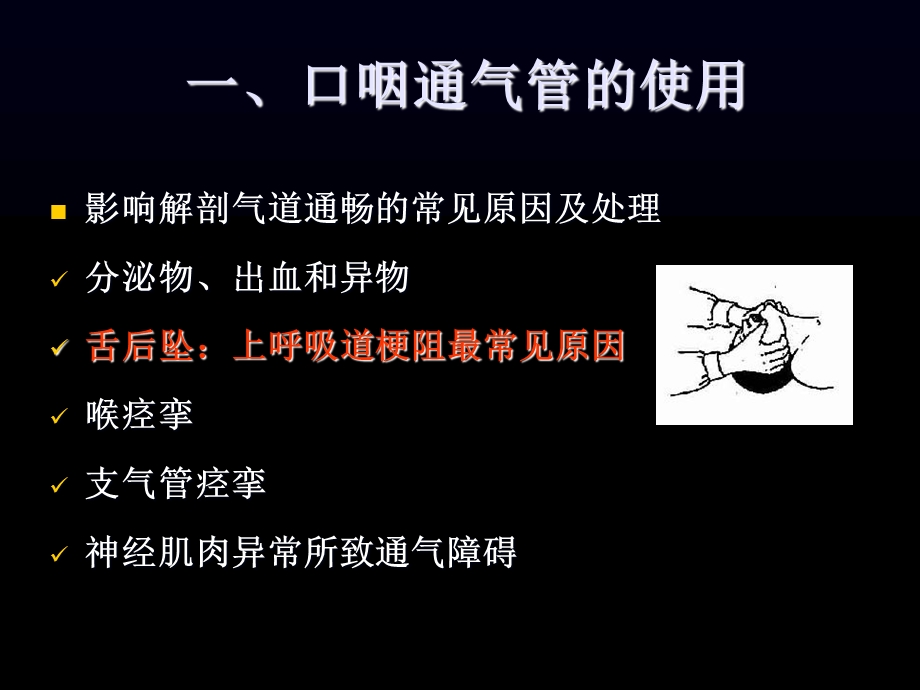 口咽通气管及简易呼吸气囊的正确应用.ppt_第3页